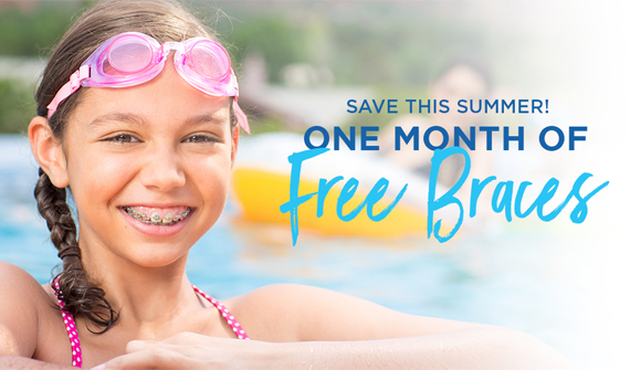Free Braces