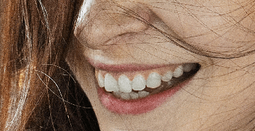 dental-trauma-thumbnail